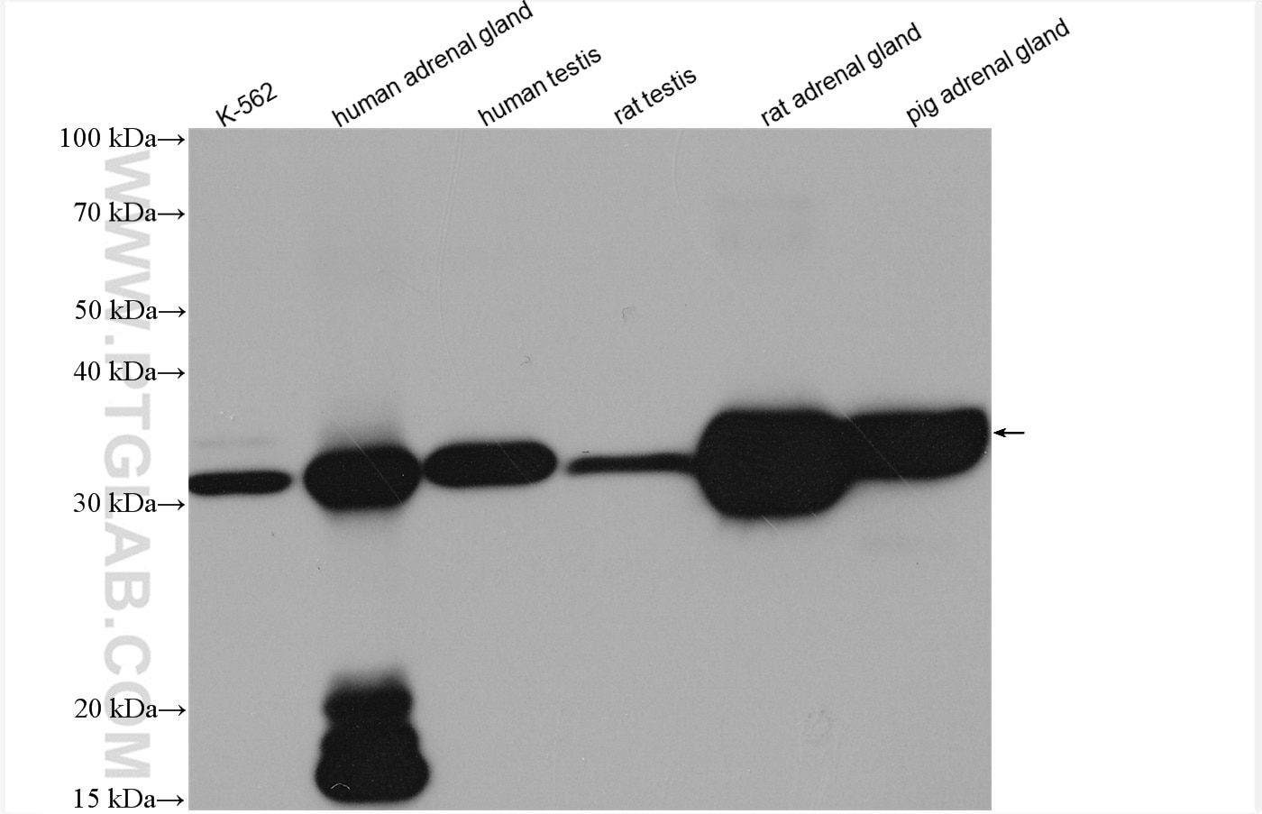 Western Blot (WB) analysis of various lysates using STAR Recombinant antibody (80751-1-RR)