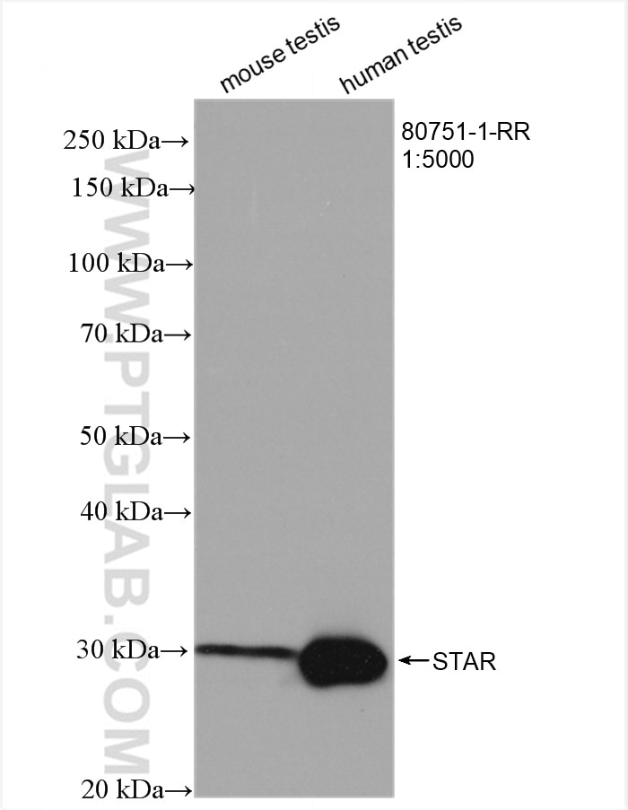 Western Blot (WB) analysis of various lysates using STAR Recombinant antibody (80751-1-RR)
