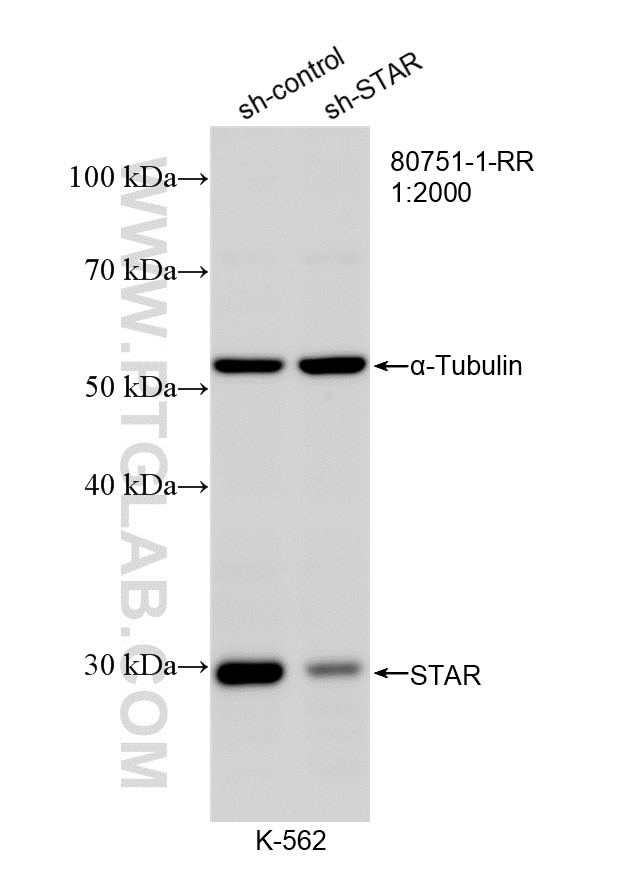 Western Blot (WB) analysis of K-562 cells using STAR Recombinant monoclonal antibody (80751-1-RR)