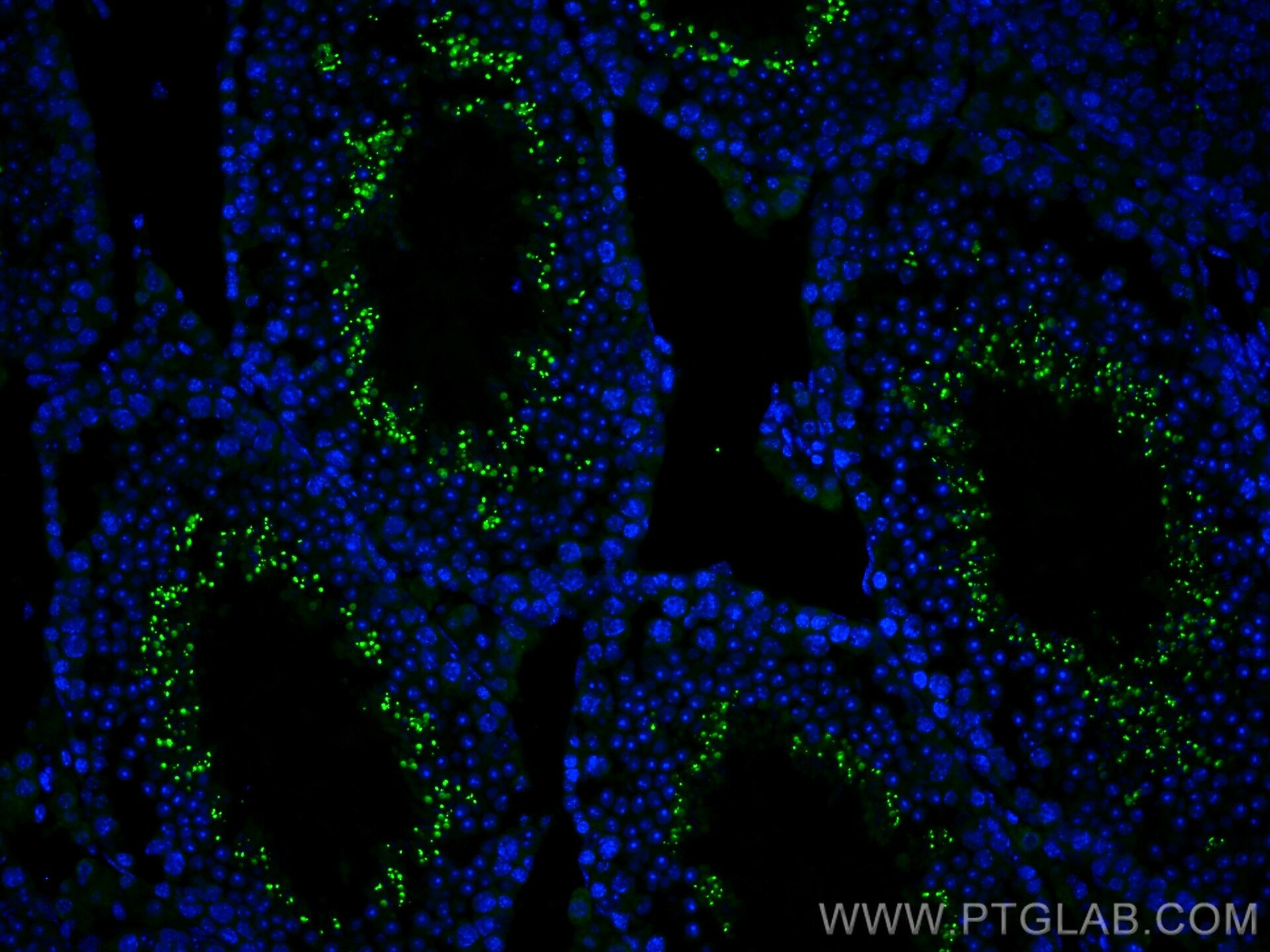 Immunofluorescence (IF) / fluorescent staining of mouse testis tissue using CoraLite® Plus 488-conjugated STAR Polyclonal anti (CL488-12225)