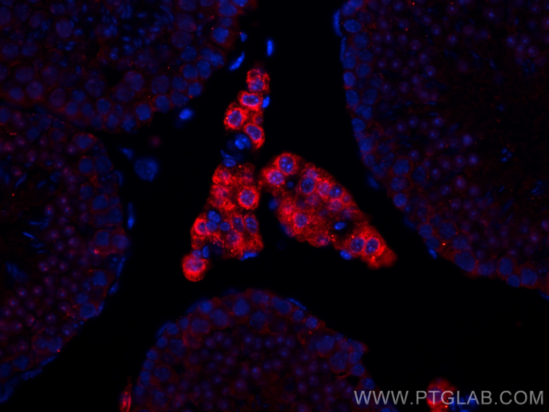 Immunofluorescence (IF) / fluorescent staining of mouse testis tissue using CoraLite®594-conjugated STAR Monoclonal antibody (CL594-67130)