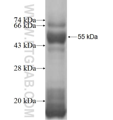 STAR fusion protein Ag2862 SDS-PAGE
