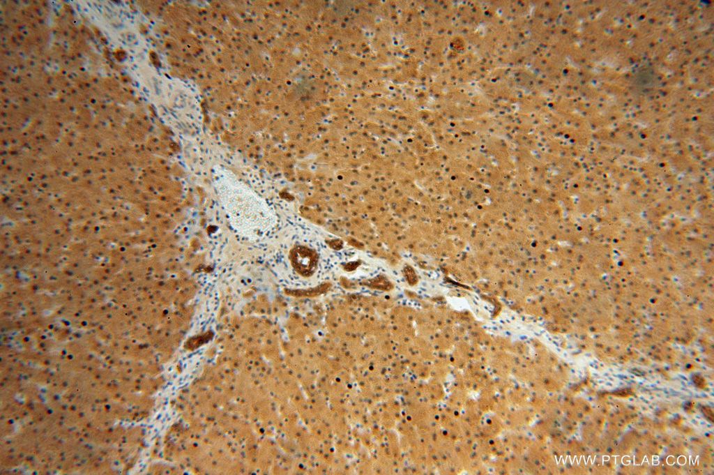 Immunohistochemistry (IHC) staining of human liver tissue using STARD10 Polyclonal antibody (17048-1-AP)