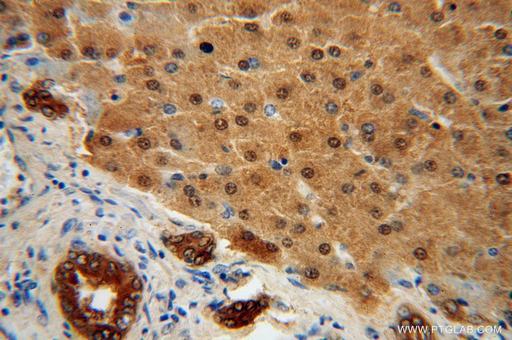 Immunohistochemistry (IHC) staining of human liver tissue using STARD10 Polyclonal antibody (17048-1-AP)