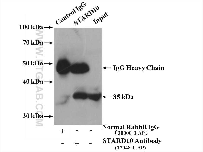 Immunoprecipitation (IP) experiment of HepG2 cells using STARD10 Polyclonal antibody (17048-1-AP)