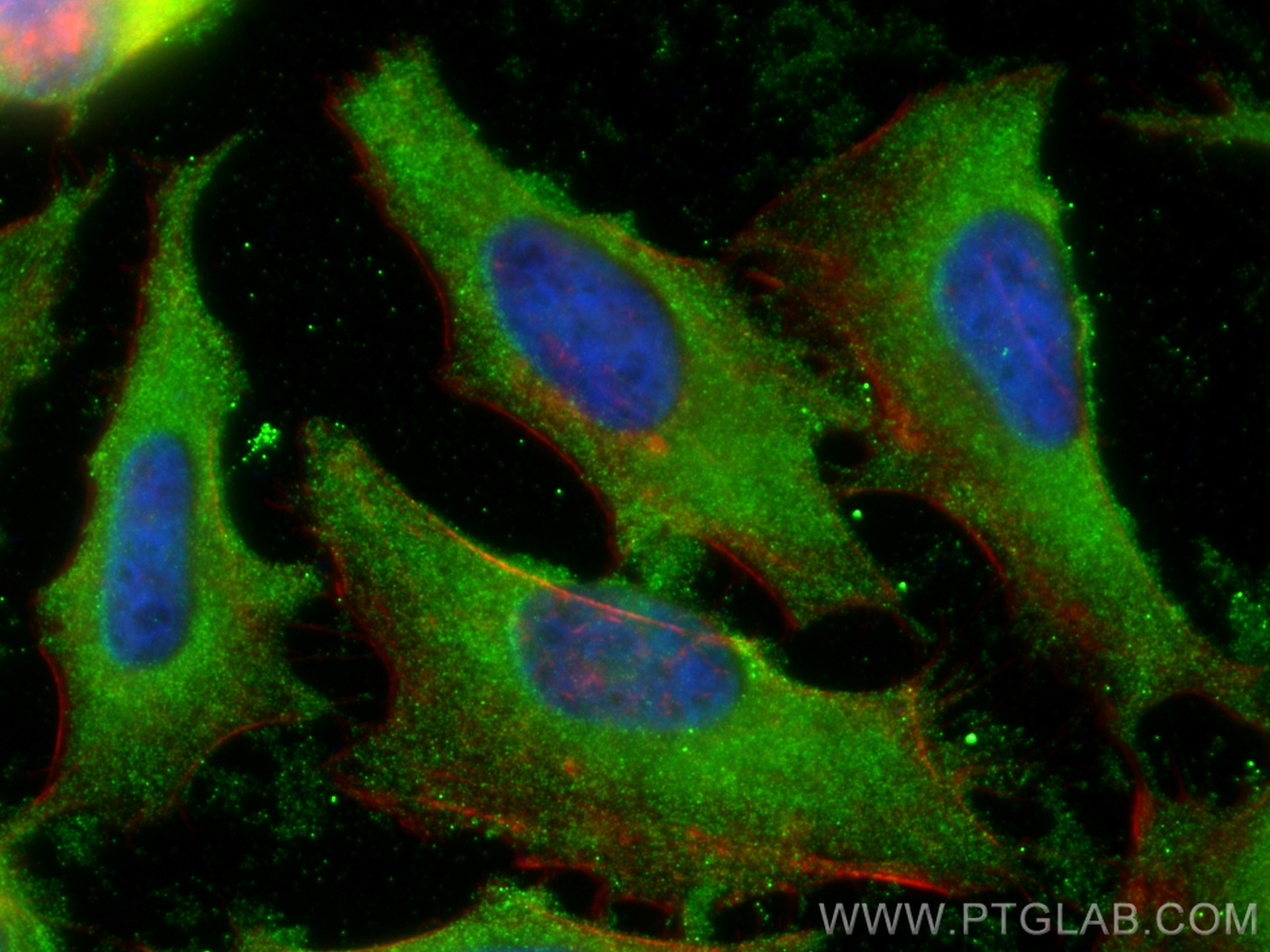 Immunofluorescence (IF) / fluorescent staining of HeLa cells using STARD10 Monoclonal antibody (68554-1-Ig)