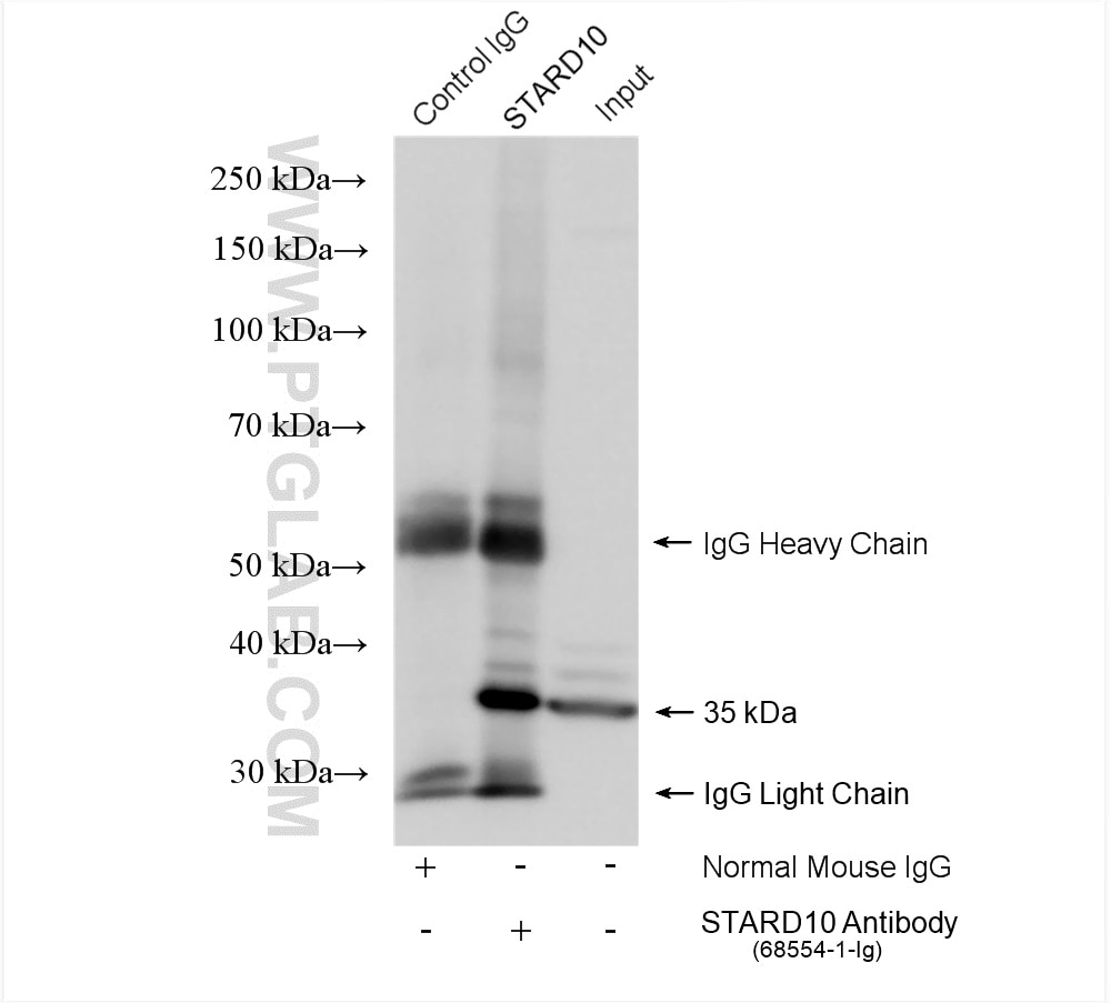 Immunoprecipitation (IP) experiment of HepG2 cells using STARD10 Monoclonal antibody (68554-1-Ig)