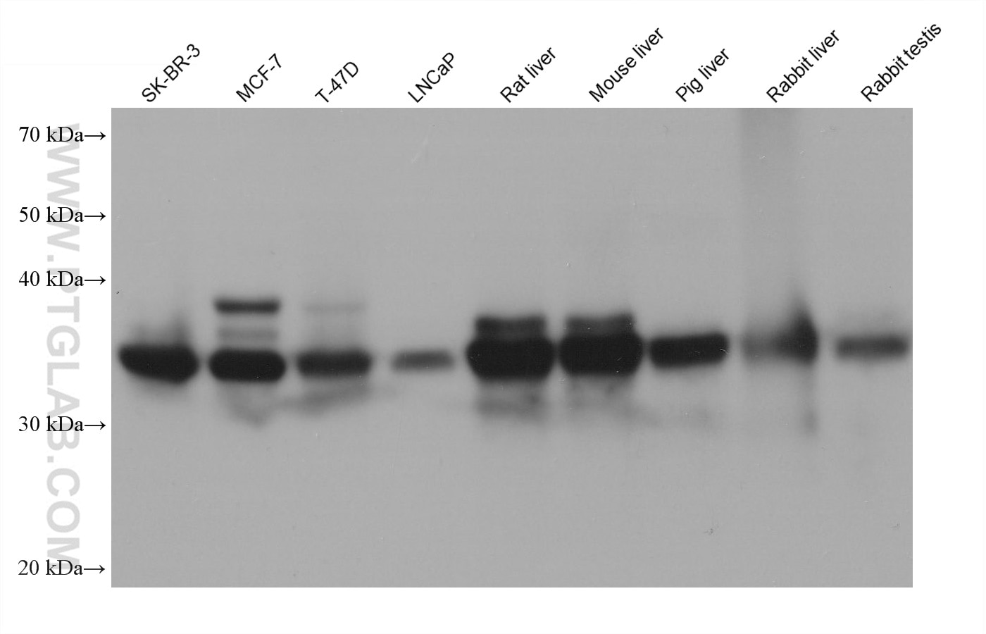 Western Blot (WB) analysis of various lysates using STARD10 Monoclonal antibody (68554-1-Ig)