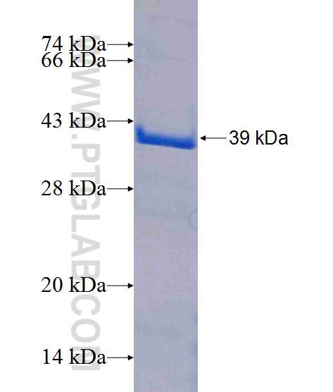 STARD10 fusion protein Ag10932 SDS-PAGE