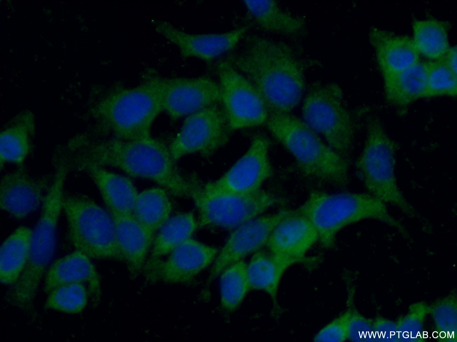 Immunofluorescence (IF) / fluorescent staining of MCF-7 cells using STARD13 Polyclonal antibody (21325-1-AP)
