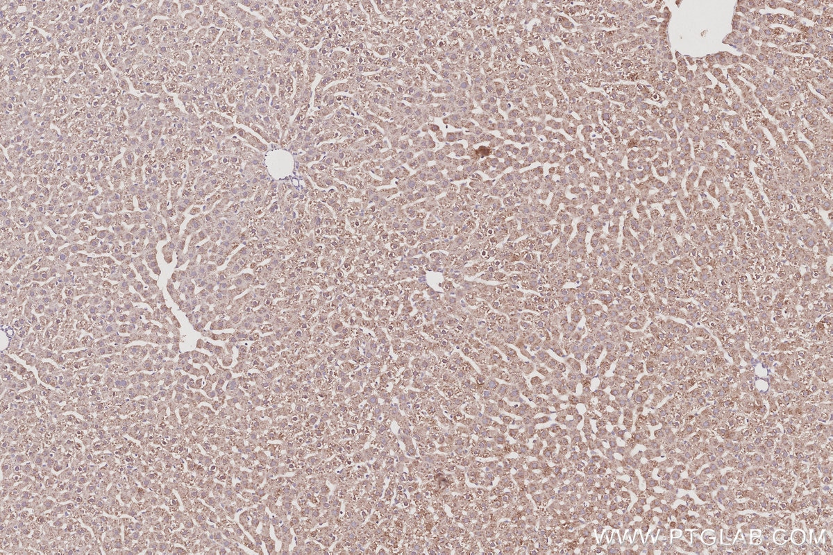 Immunohistochemistry (IHC) staining of rat liver tissue using STARD13 Polyclonal antibody (21325-1-AP)