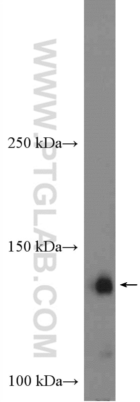 WB analysis of HeLa using 21325-1-AP