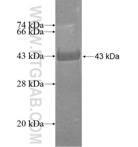 STARD13 fusion protein Ag15093 SDS-PAGE