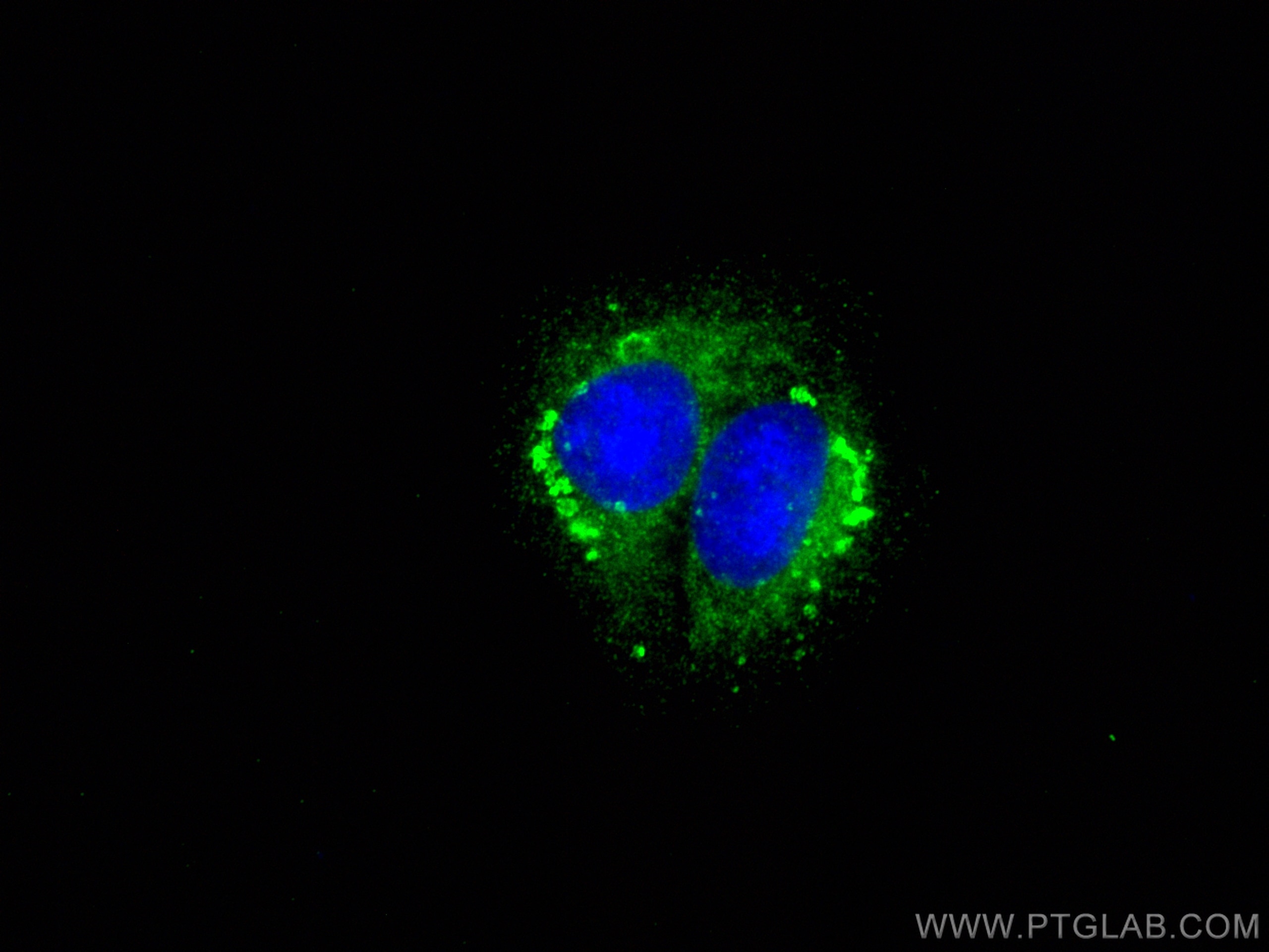 Immunofluorescence (IF) / fluorescent staining of U2OS cells using STARD3NL Polyclonal antibody (20502-1-AP)