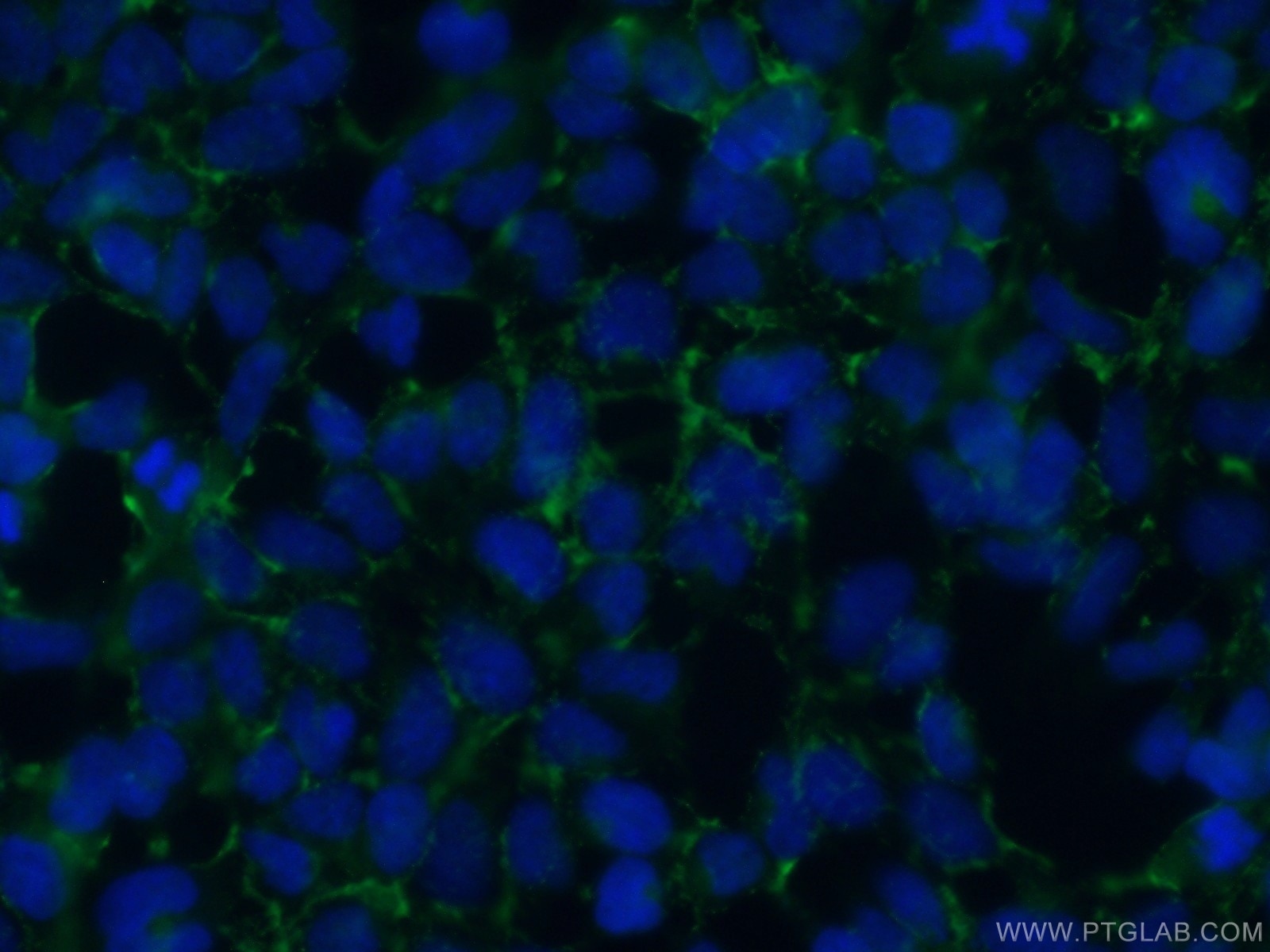 Immunofluorescence (IF) / fluorescent staining of HEK-293 cells using STARD3NL Polyclonal antibody (20502-1-AP)