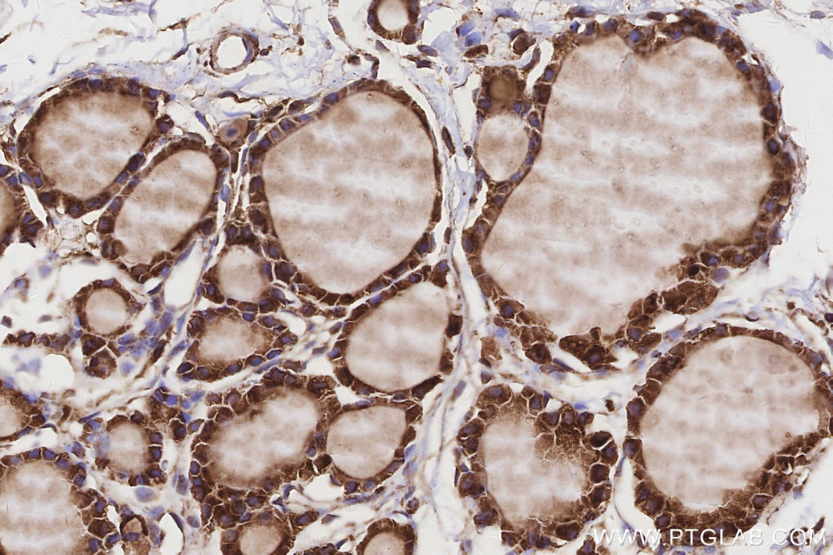 IHC staining of rat thyroid gland using 20502-1-AP Immunohistochemistry (IHC) staining of rat thyroid gland tissue using STARD3NL Polyclonal antibody (20502-1-AP)