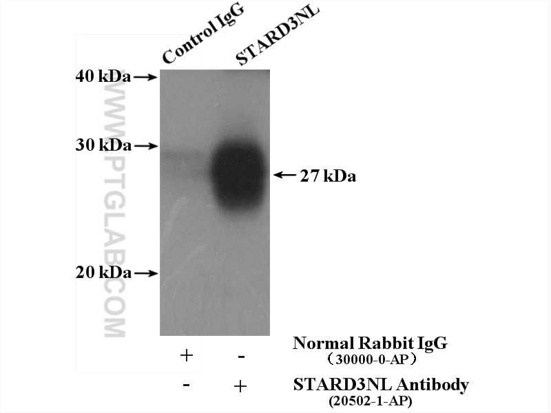 Immunoprecipitation (IP) experiment of HEK-293 cells using STARD3NL Polyclonal antibody (20502-1-AP)