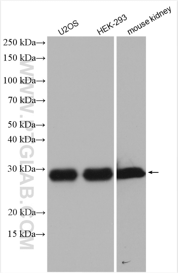 Western Blot (WB) analysis of various lysates using STARD3NL Polyclonal antibody (20502-1-AP)