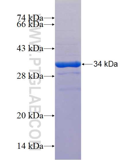 STARD3NL fusion protein Ag14273 SDS-PAGE