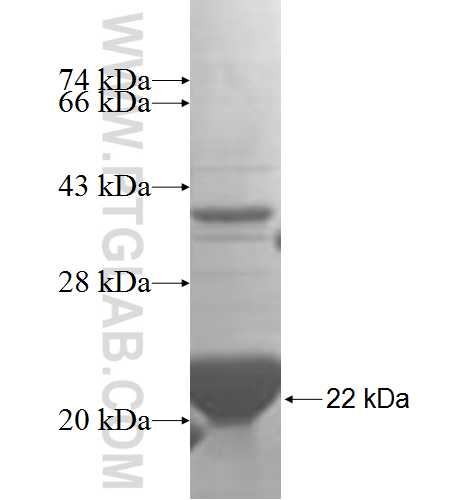 STARD4 fusion protein Ag5039 SDS-PAGE