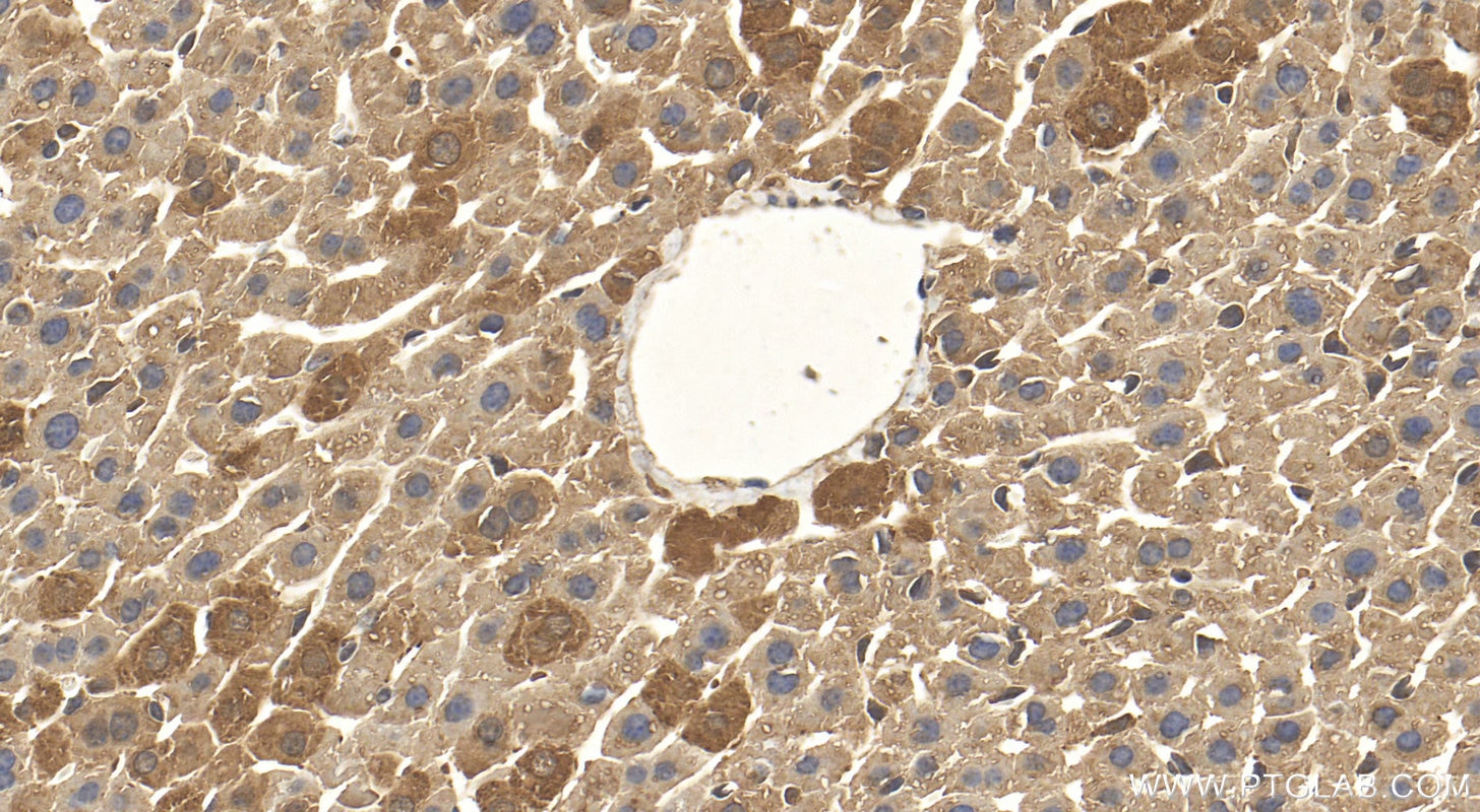 Immunohistochemistry (IHC) staining of mouse liver tissue using STARD5 Polyclonal antibody (10487-1-AP)