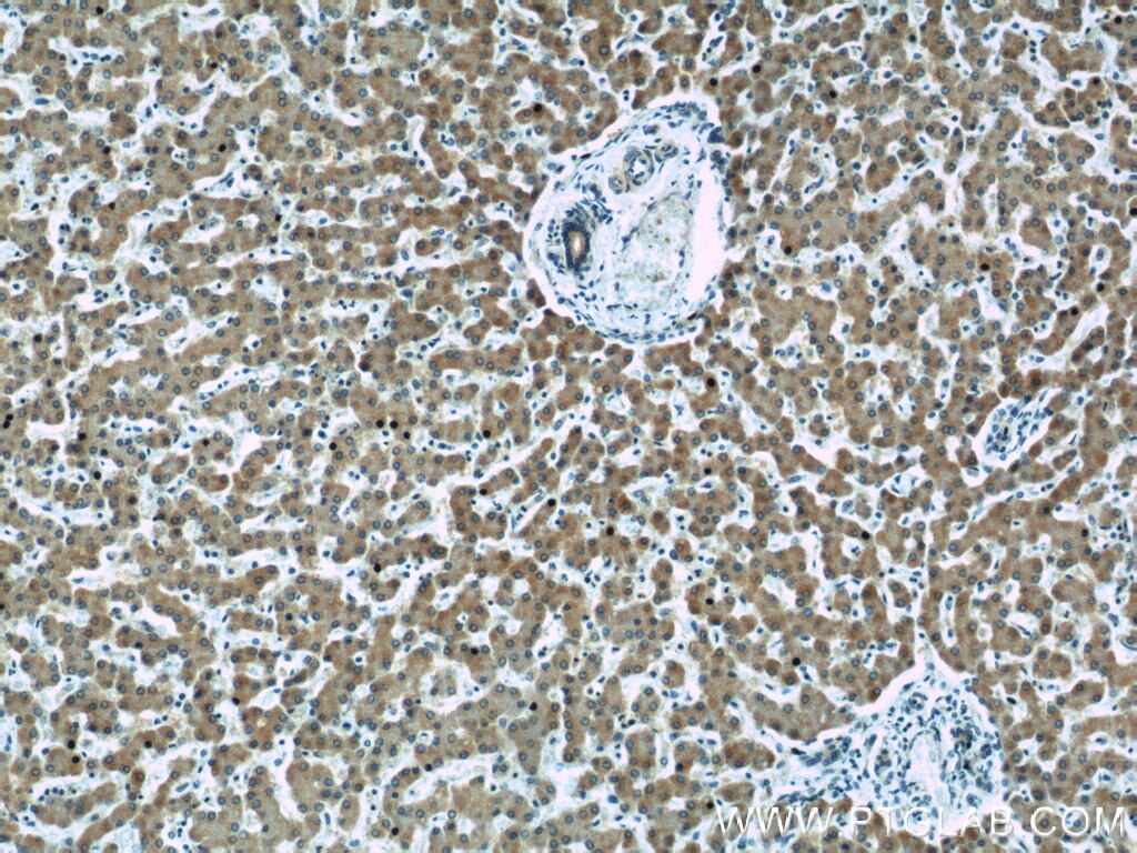 Immunohistochemistry (IHC) staining of human liver tissue using STARD5 Polyclonal antibody (10487-1-AP)