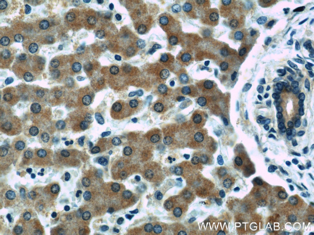 Immunohistochemistry (IHC) staining of human liver tissue using STARD5 Polyclonal antibody (10487-1-AP)