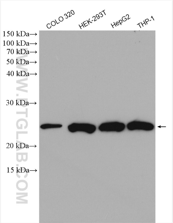 Western Blot (WB) analysis of various lysates using STARD5 Polyclonal antibody (10487-1-AP)