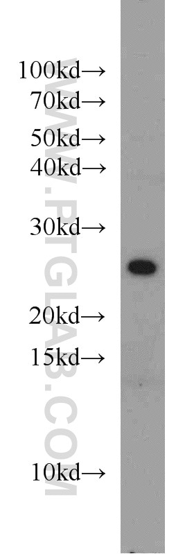 Western Blot (WB) analysis of mouse liver tissue using STARD5 Polyclonal antibody (10487-1-AP)