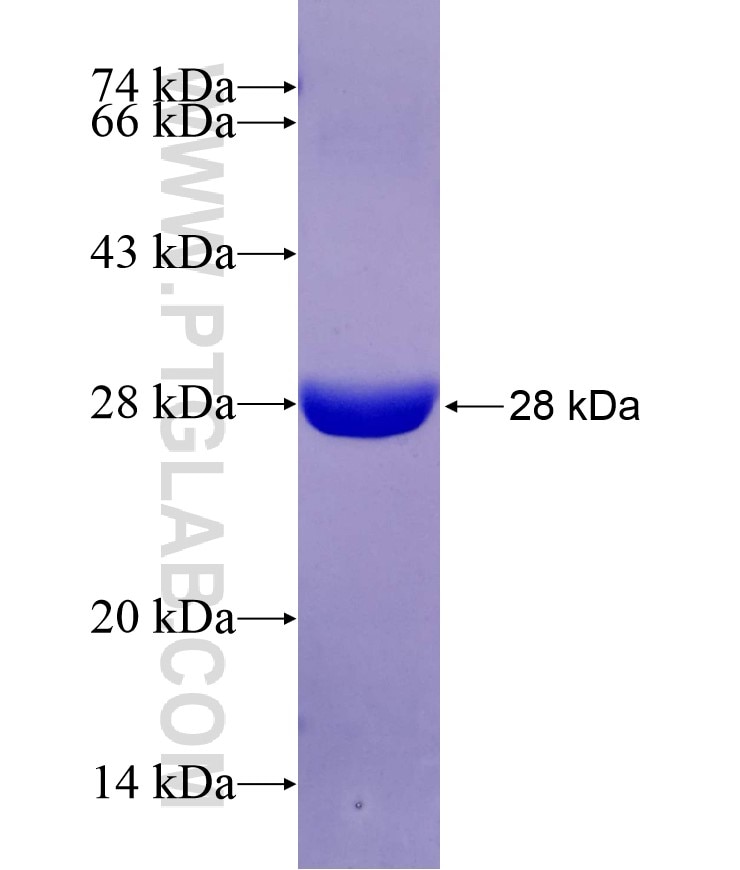 STARD5 fusion protein Ag29618 SDS-PAGE