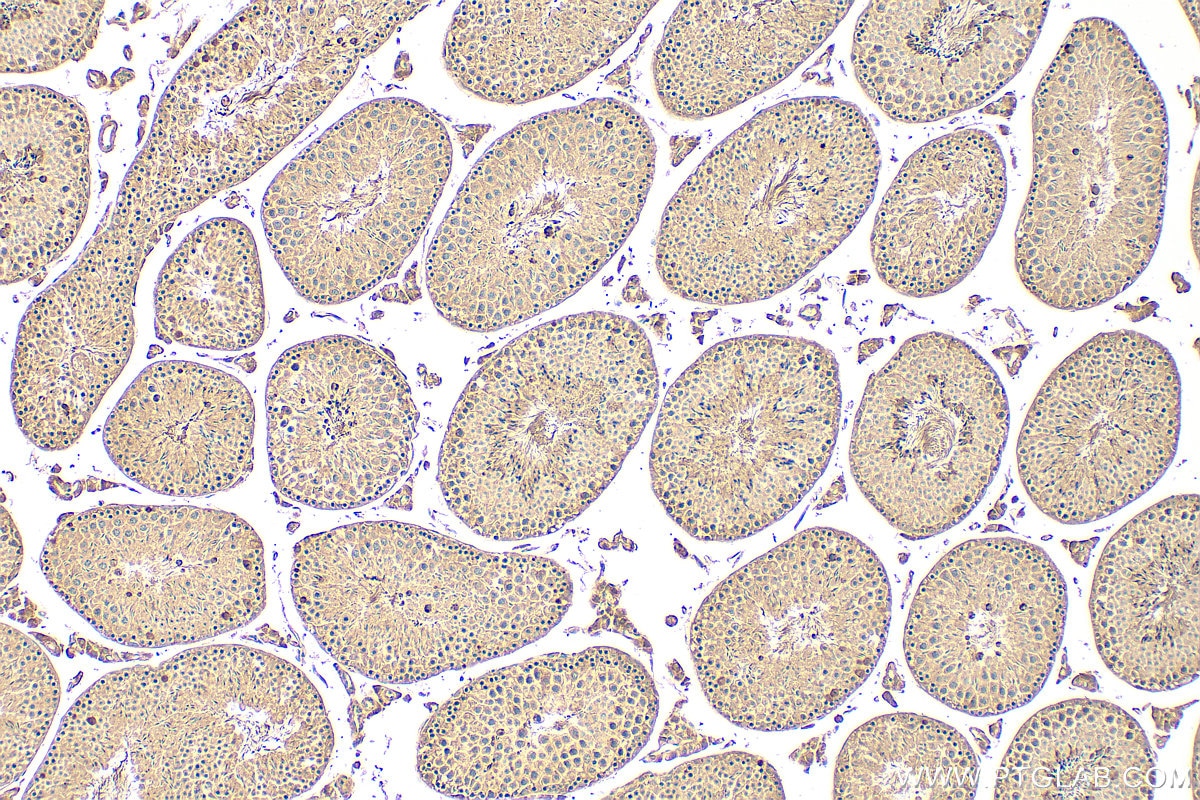 Immunohistochemistry (IHC) staining of mouse testis tissue using STARD7 Polyclonal antibody (15689-1-AP)