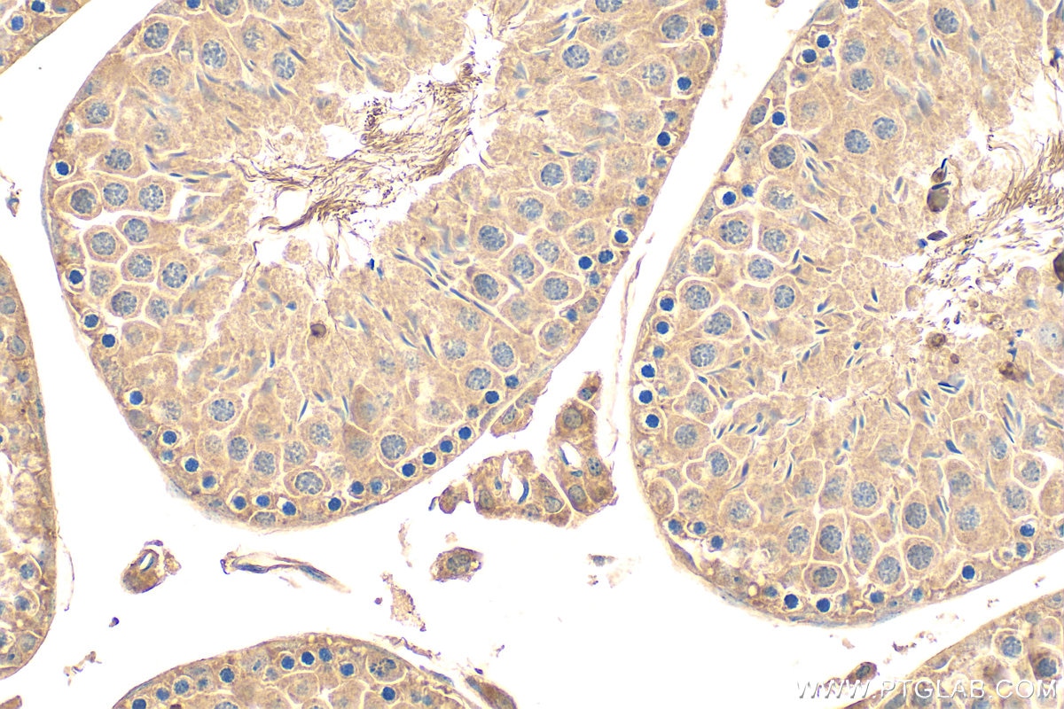 Immunohistochemistry (IHC) staining of mouse testis tissue using STARD7 Polyclonal antibody (15689-1-AP)