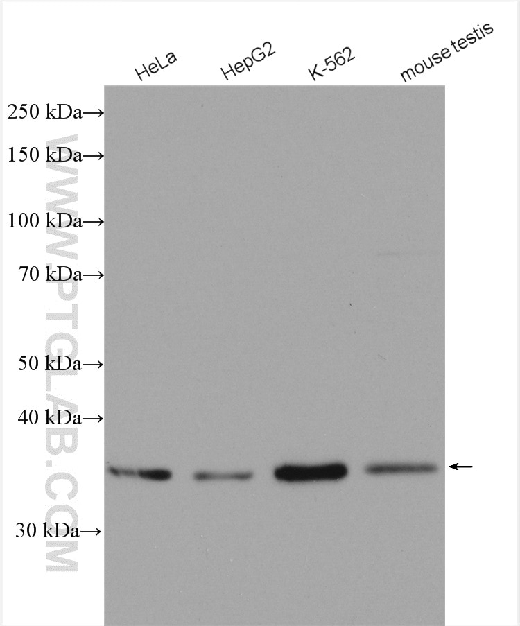 Western Blot (WB) analysis of various lysates using STARD7 Polyclonal antibody (15689-1-AP)