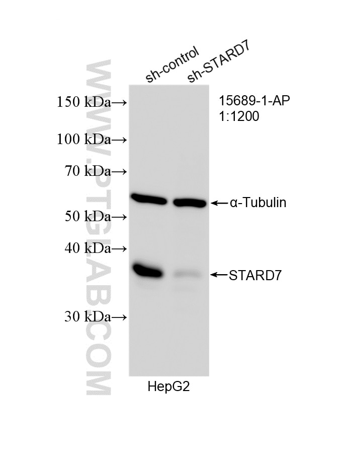 WB analysis of HepG2 using 15689-1-AP Western Blot (WB) analysis of HepG2 cells using STARD7 Polyclonal antibody (15689-1-AP)