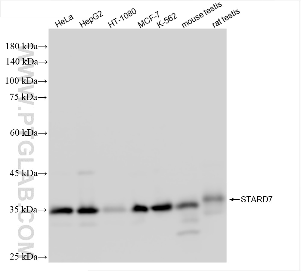 Western Blot (WB) analysis of various lysates using STARD7 Recombinant antibody (85131-4-RR)