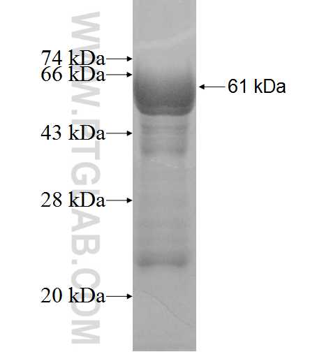 STARD7 fusion protein Ag8224 SDS-PAGE