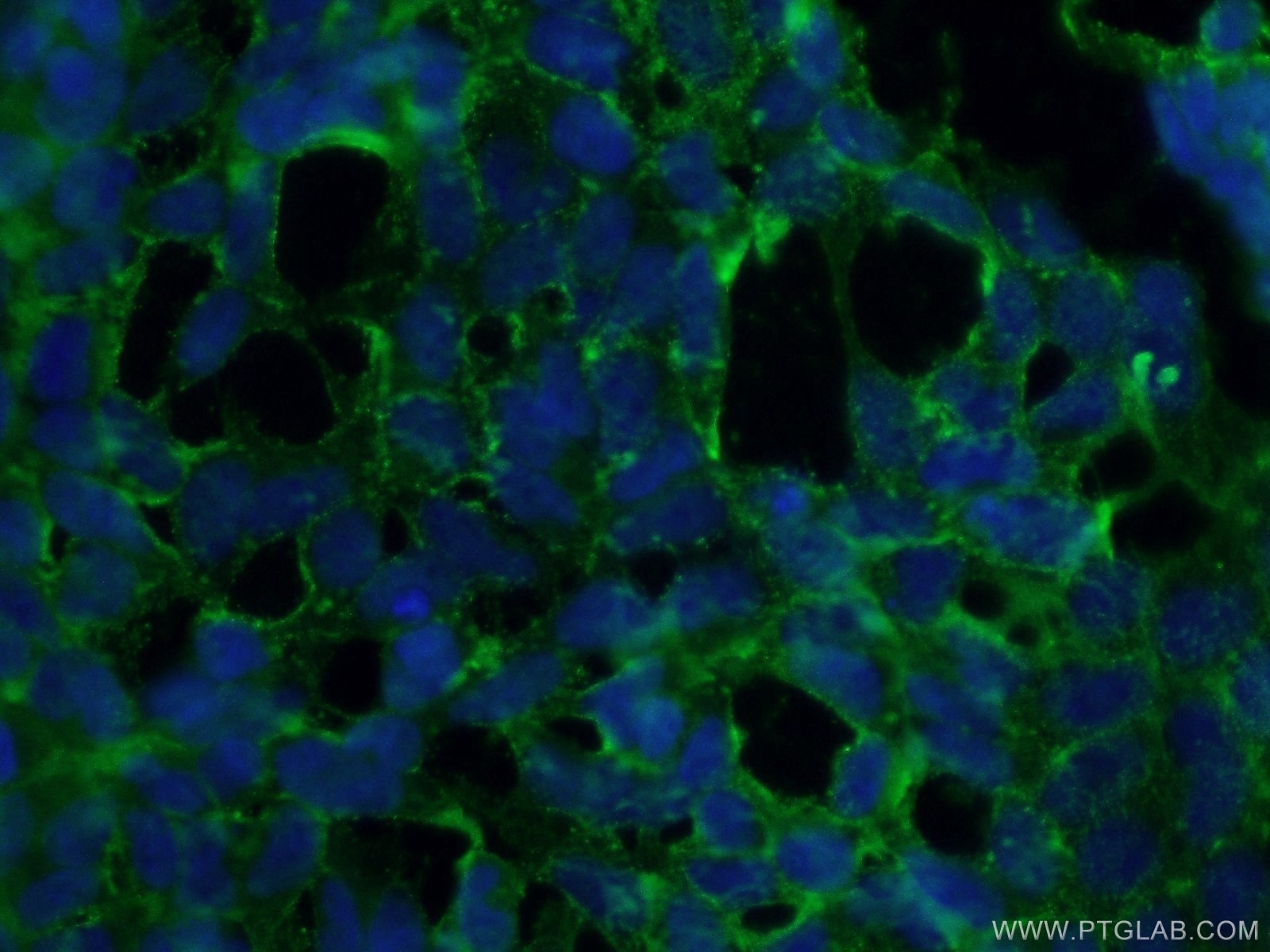 Immunofluorescence (IF) / fluorescent staining of HEK-293 cells using STARD8 Polyclonal antibody (13899-1-AP)