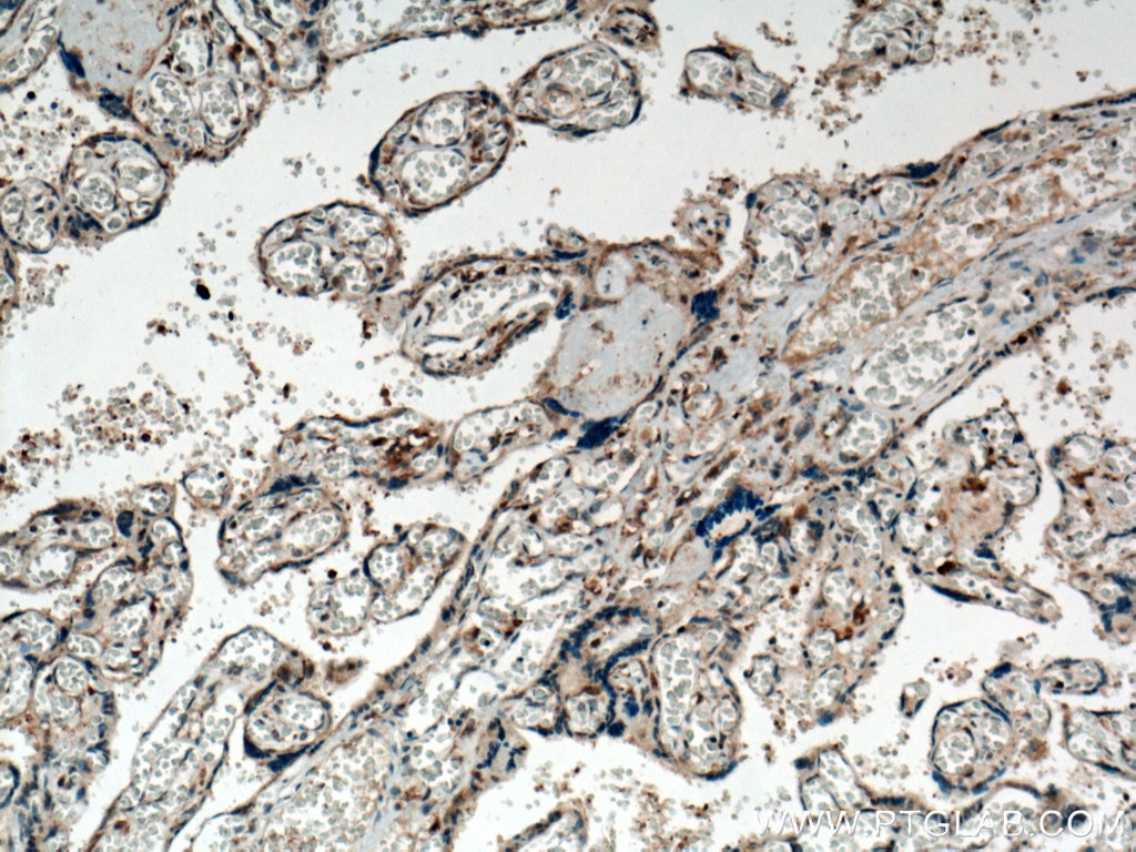 Immunohistochemistry (IHC) staining of human placenta tissue using STARD8 Polyclonal antibody (13899-1-AP)
