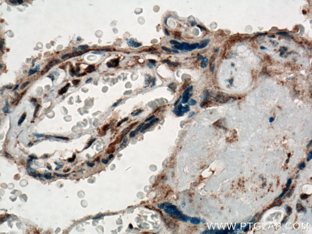 Immunohistochemistry (IHC) staining of human placenta tissue using STARD8 Polyclonal antibody (13899-1-AP)