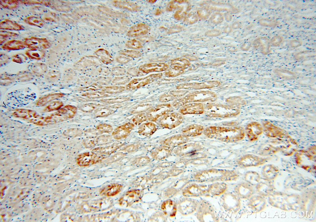 Immunohistochemistry (IHC) staining of human kidney tissue using STARD8 Polyclonal antibody (13899-1-AP)