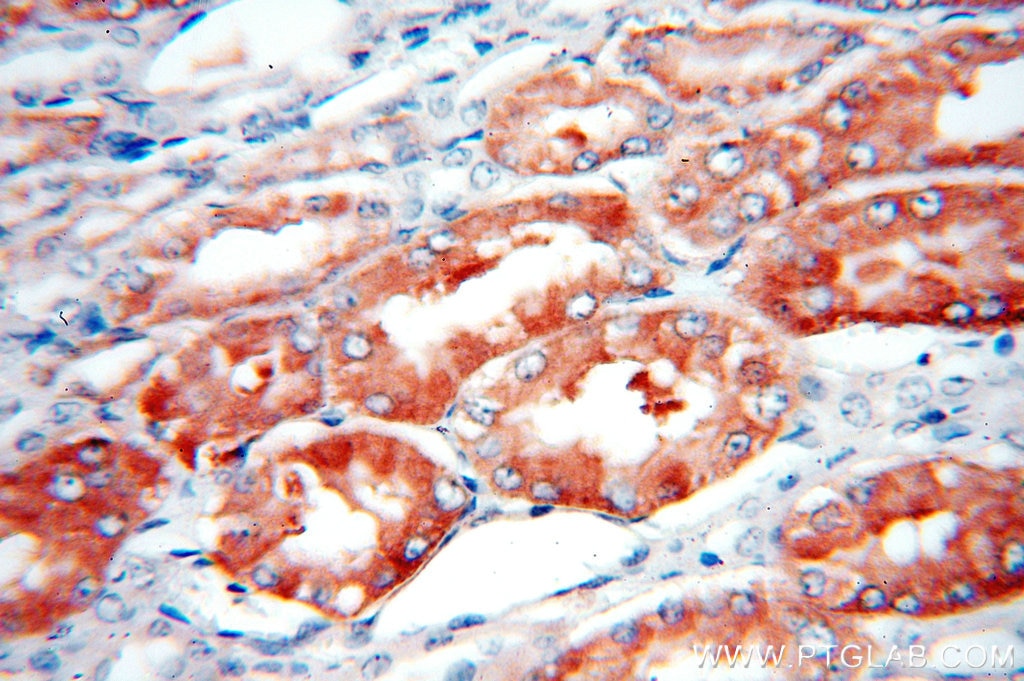 Immunohistochemistry (IHC) staining of human kidney tissue using STARD8 Polyclonal antibody (13899-1-AP)