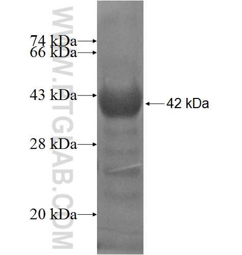 STARD8 fusion protein Ag4865 SDS-PAGE