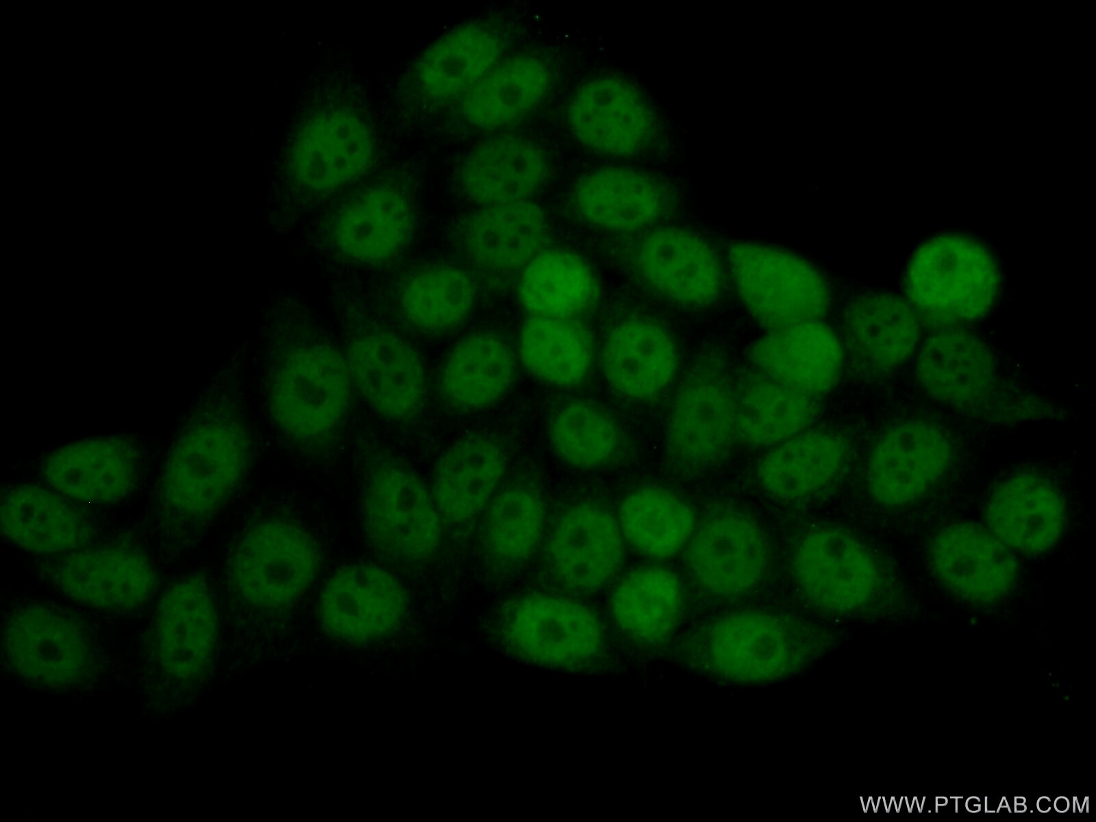 Immunofluorescence (IF) / fluorescent staining of PC-3 cells using STAT1 Polyclonal antibody (10144-2-AP)