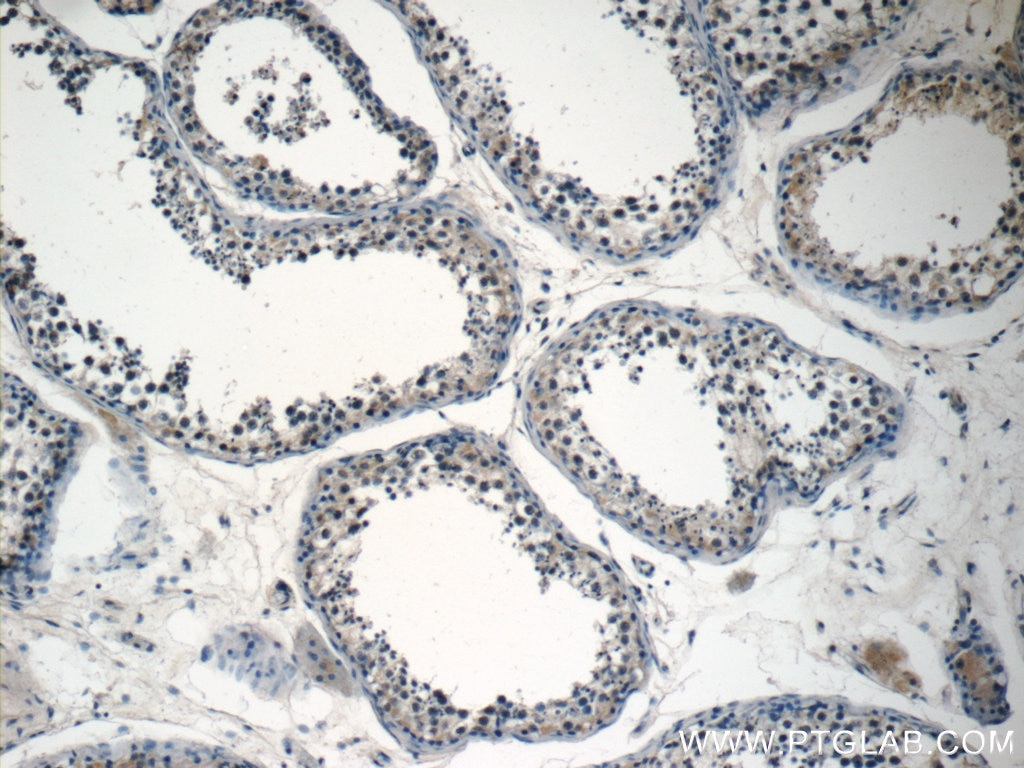 IHC staining of human testis using 10144-2-AP