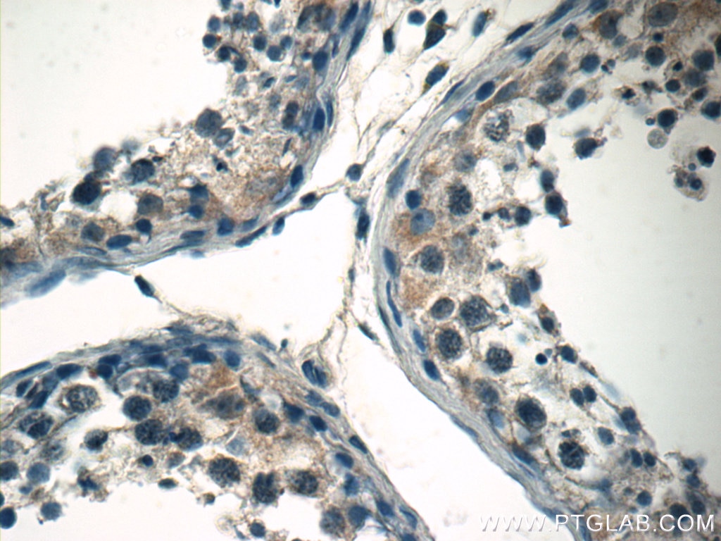 Immunohistochemistry (IHC) staining of human testis tissue using STAT1 Polyclonal antibody (10144-2-AP)