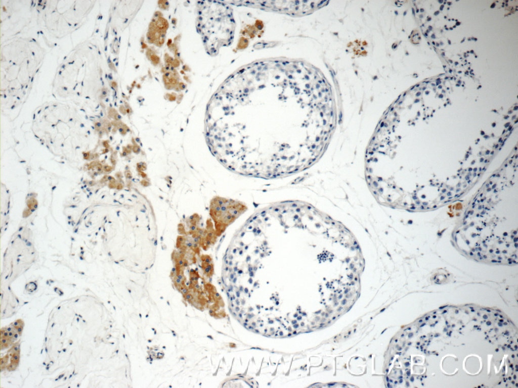 Immunohistochemistry (IHC) staining of human testis tissue using STAT1 Polyclonal antibody (10144-2-AP)