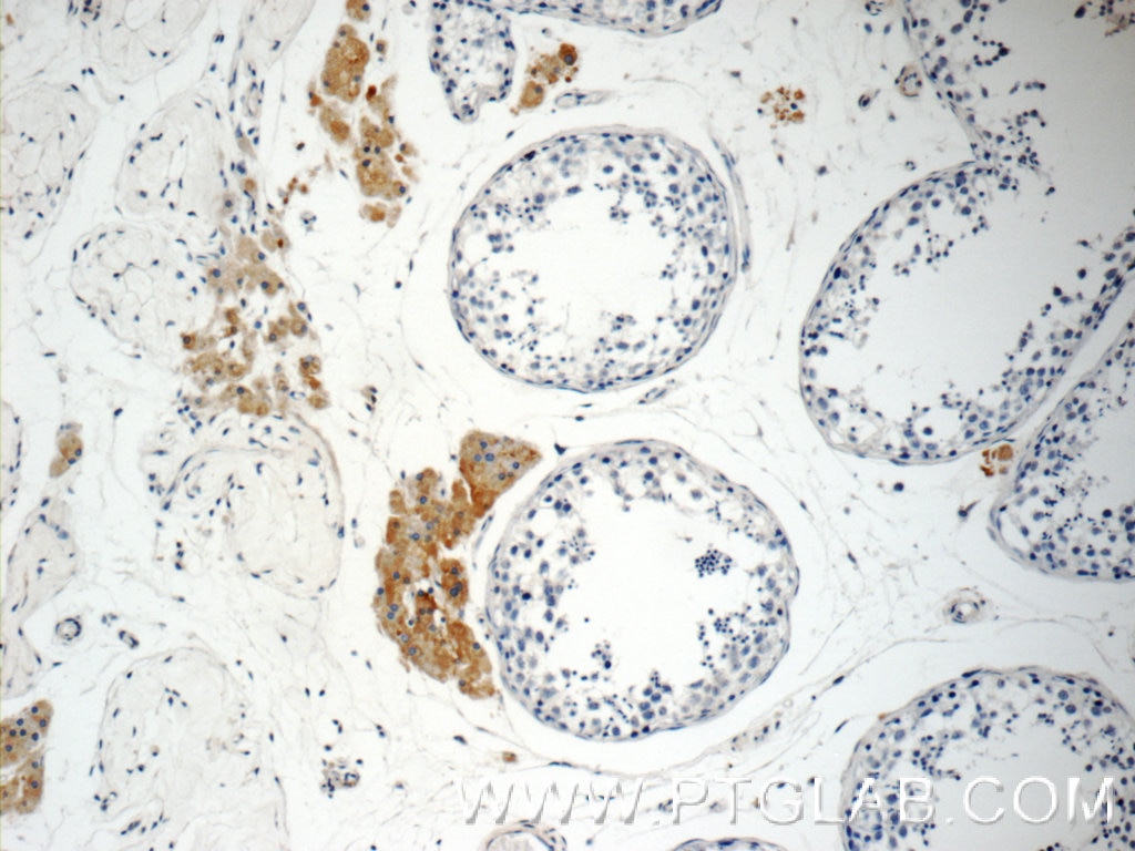 IHC staining of human testis using 10144-2-AP