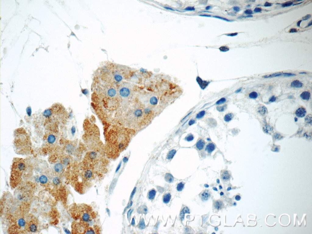 Immunohistochemistry (IHC) staining of human testis tissue using STAT1 Polyclonal antibody (10144-2-AP)