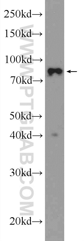 Western Blot (WB) analysis of HepG2 cells using STAT1 Polyclonal antibody (10144-2-AP)