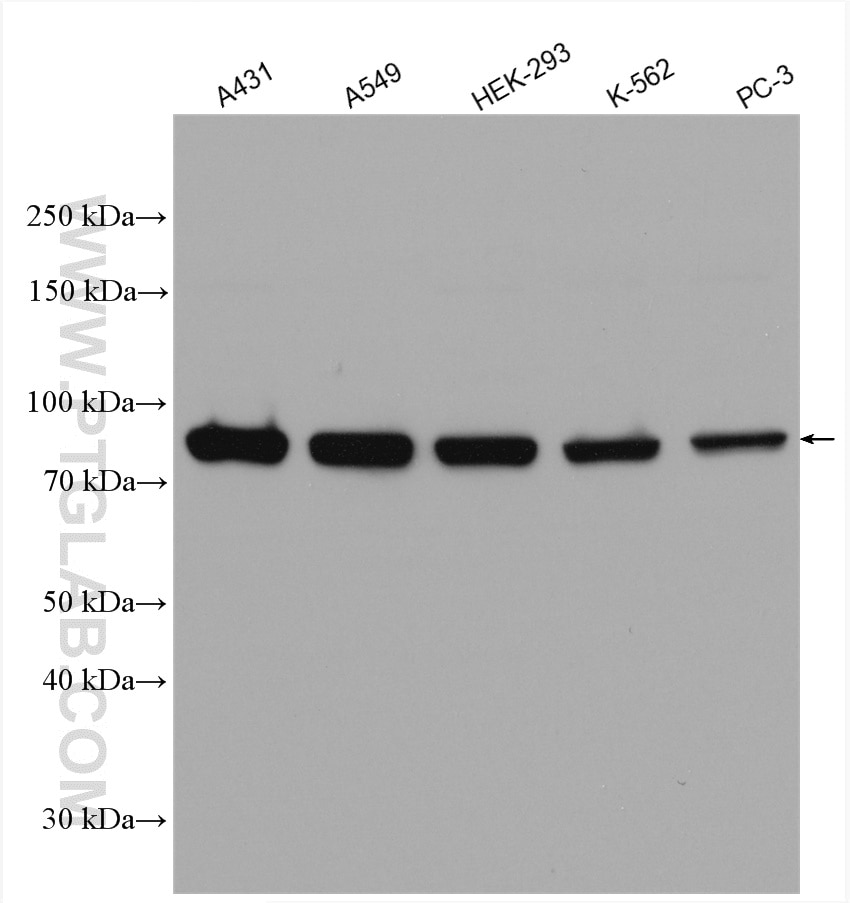 Western Blot (WB) analysis of various lysates using STAT1 Polyclonal antibody (10144-2-AP)